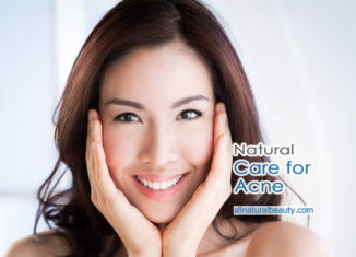 Natural Treatment for Acne