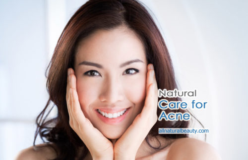 Natural Treatment for Acne